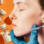 the-rise-of-the-botox-party-how-workplace-bonding-is-evolving-beyond-happy-hours